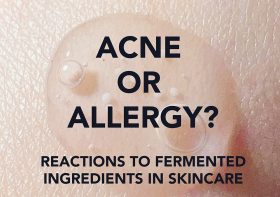Acne or Allergy: Can Fermented Skincare Cause Acne Breakouts?