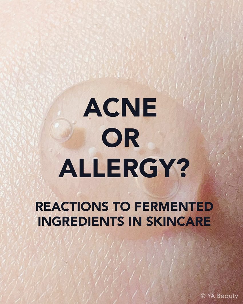 Photo of fermented ingredient on skin, with the question asking "Acne or Allergy? Reactions to Fermented Ingredients in Skincare"