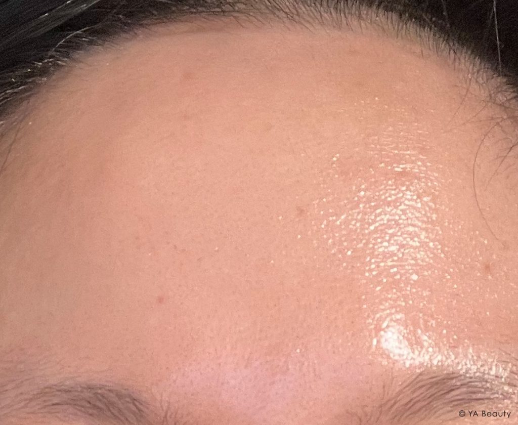 Clean and healthy skin on forehead that's recovering after taking a break from fermented skincare that caused my acne breakouts.